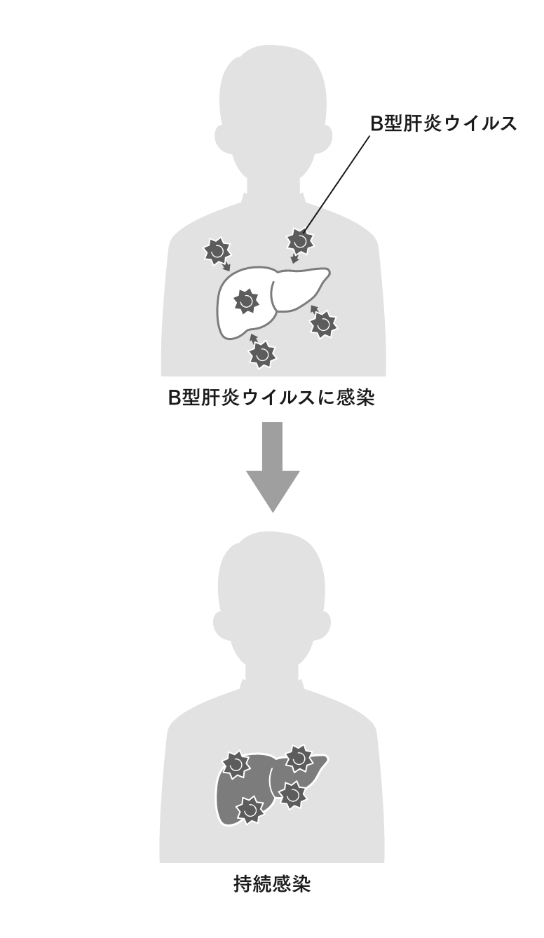 B型肝炎が発症するしくみ