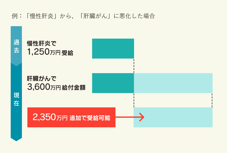 慢性肝炎から、肝臓がんに悪化した場合のグラフ